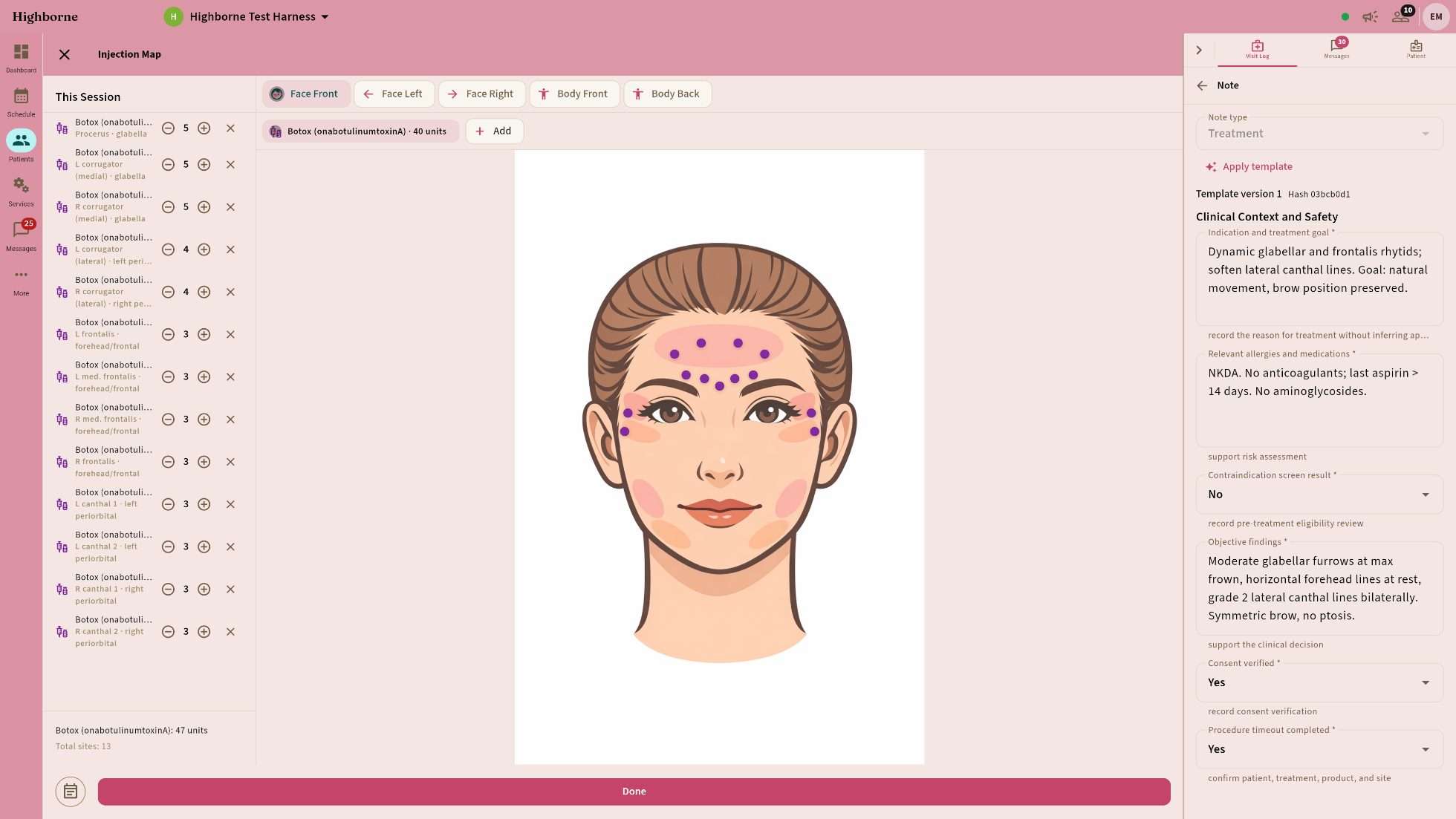 Botox injection map on the face with thirteen sites, dose per site, and the structured clinical note being written beside it